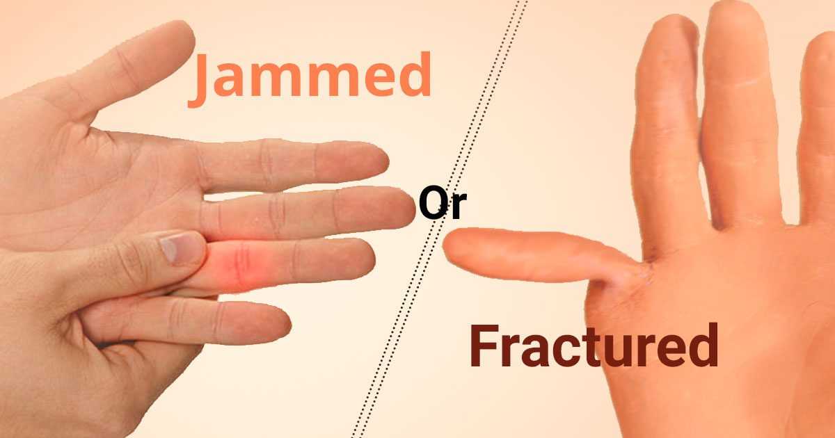 what to do when you jam your thumb