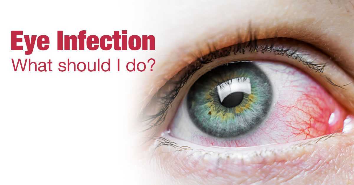 An Overview Of Eye Infections Symptoms, Causes & Treatment!