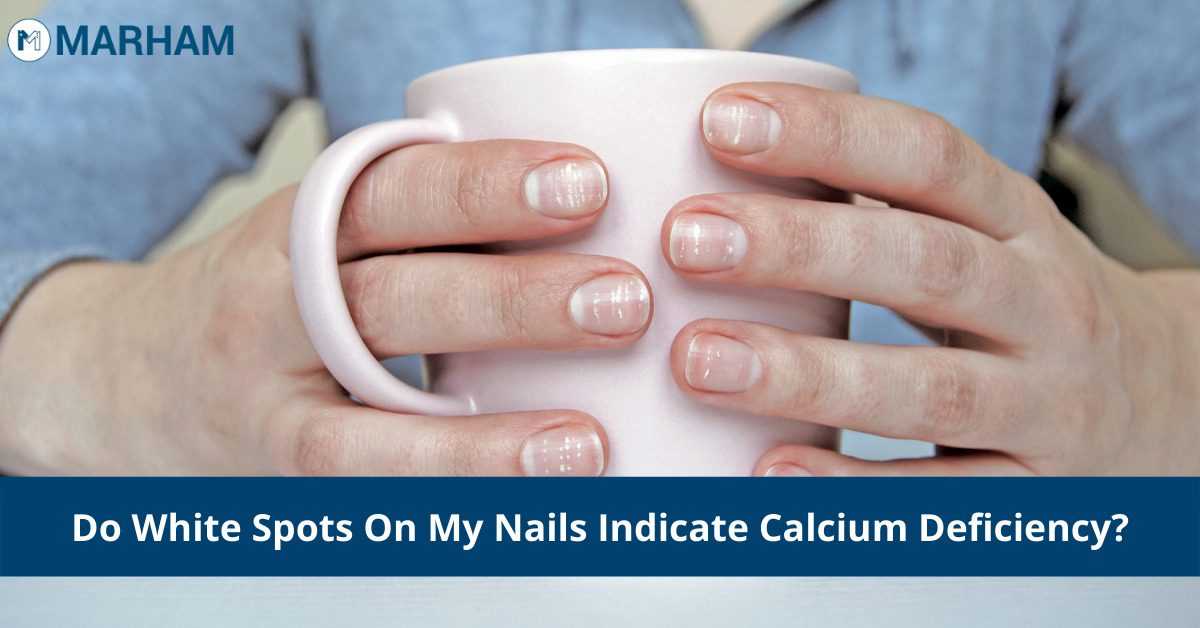 What deficiency causes white spots on nails?