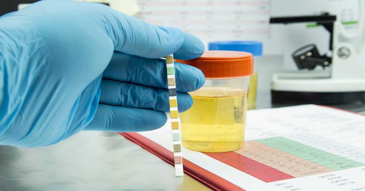 4 Reasons Why do Gynecologists Do Urine Tests | Marham