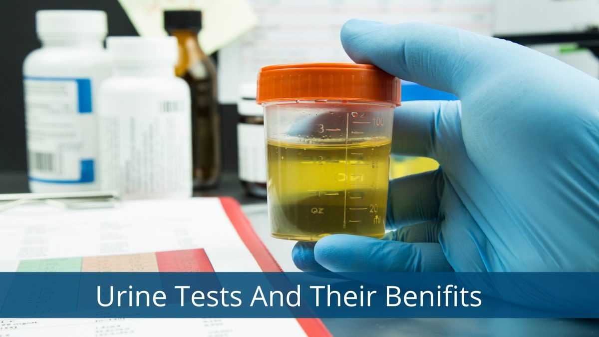 4 Reasons Why do Gynecologists Do Urine Tests | Marham