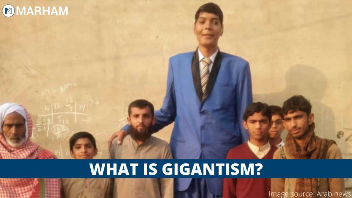 Gigantism 101: Symptoms, Causes, And Treatment | Marham