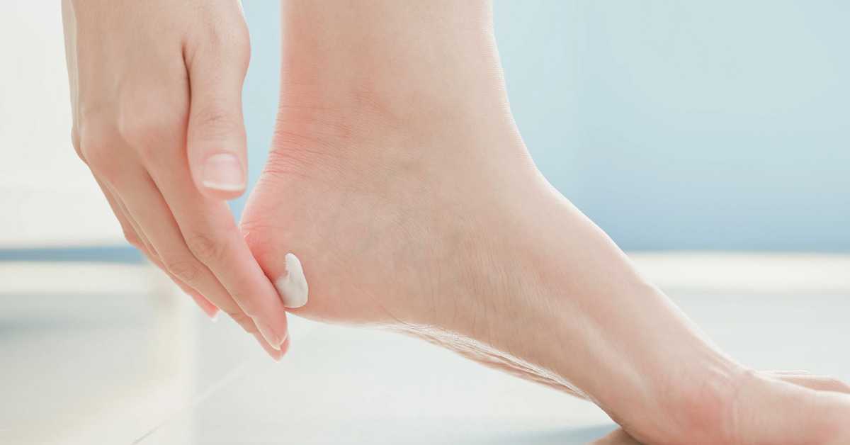 10 Ways to Dissolve (and Prevent) Dead Skin Buildup on Your Feet
