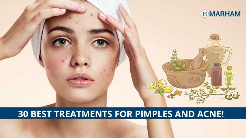 How To Remove Pimples Naturally And Permanently Marham
