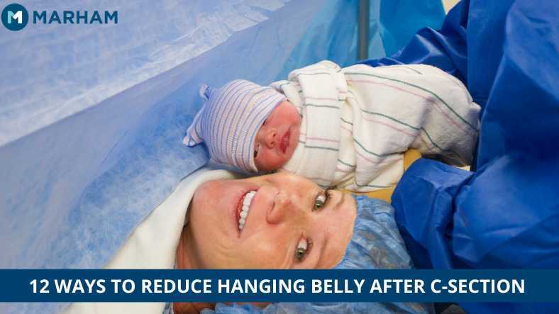 How to Get Rid of Hanging Belly after C-Section? 12 Ways to Know