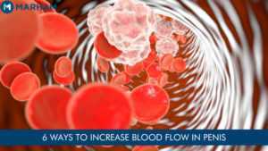 How To Increase Blood Flow To Pennis Naturally? | Marham