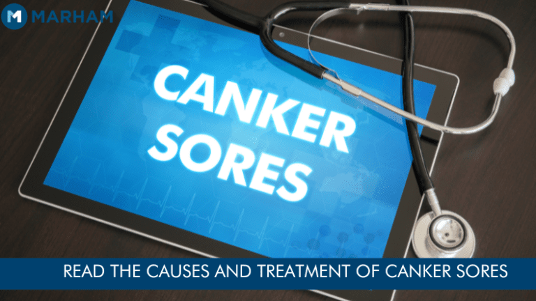 Canker Sore Symptoms, Causes And Treatment | Marham