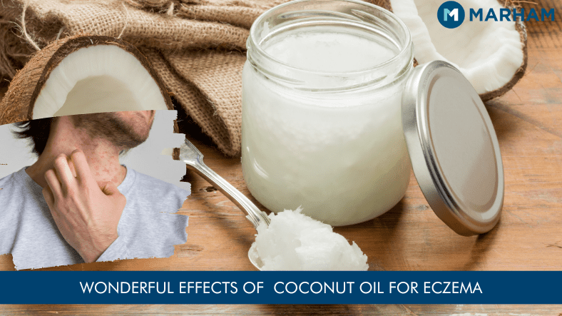 Coconut Oil For Eczema Benefits Uses And Risk Marham