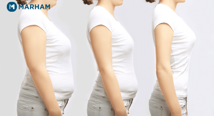 How to get rid of your hanging belly after a c-section - Mama of Five
