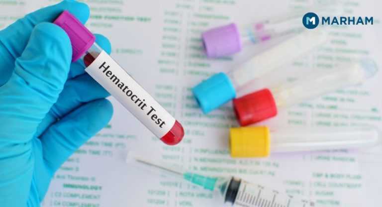 What Is Hematocrit Test: High, Low, And Normal HCT